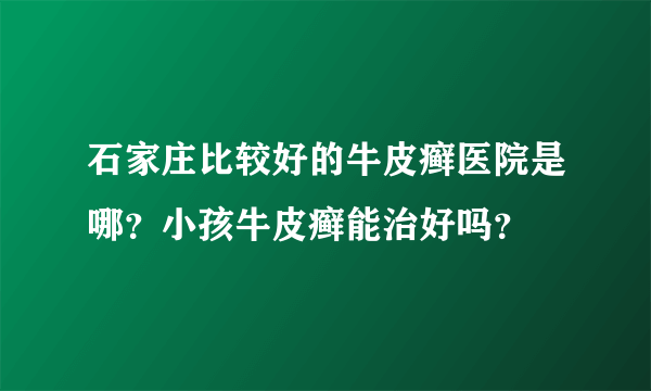 石家庄比较好的牛皮癣医院是哪？小孩牛皮癣能治好吗？