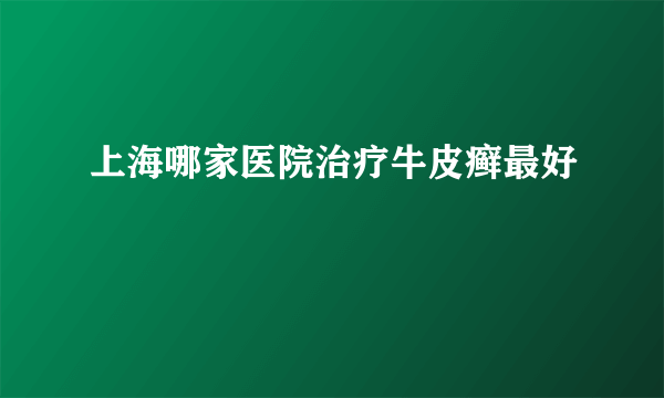 上海哪家医院治疗牛皮癣最好