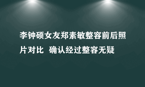 李钟硕女友郑素敏整容前后照片对比  确认经过整容无疑