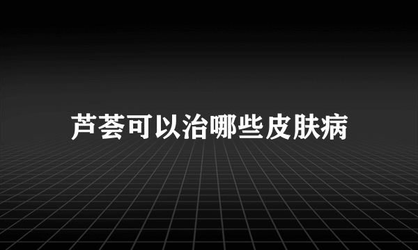 芦荟可以治哪些皮肤病