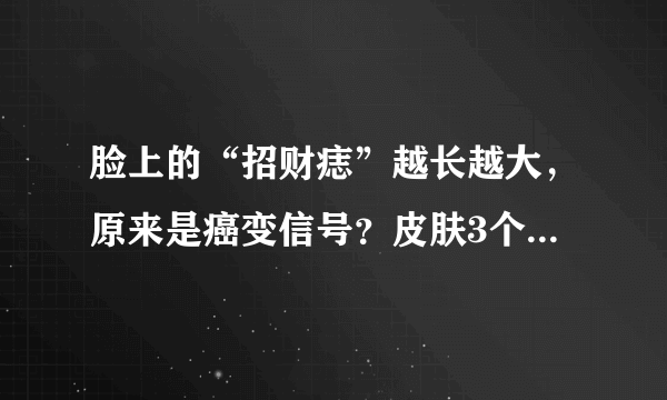 脸上的“招财痣”越长越大，原来是癌变信号？皮肤3个异常要留心