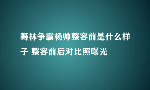 舞林争霸杨帅整容前是什么样子 整容前后对比照曝光