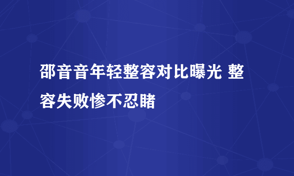 邵音音年轻整容对比曝光 整容失败惨不忍睹