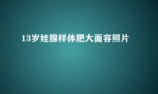 13岁娃腺样体肥大面容照片