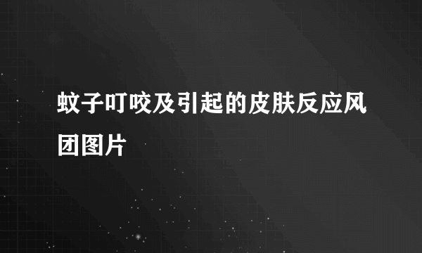 蚊子叮咬及引起的皮肤反应风团图片