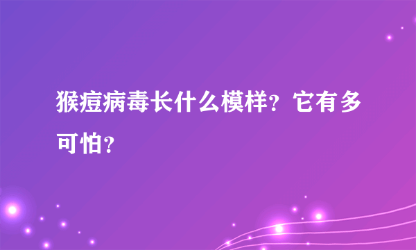 猴痘病毒长什么模样？它有多可怕？