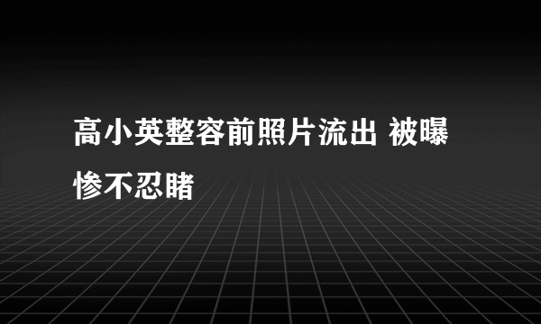 高小英整容前照片流出 被曝惨不忍睹