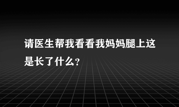 请医生帮我看看我妈妈腿上这是长了什么？