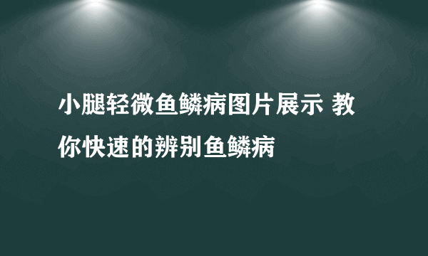 小腿轻微鱼鳞病图片展示 教你快速的辨别鱼鳞病