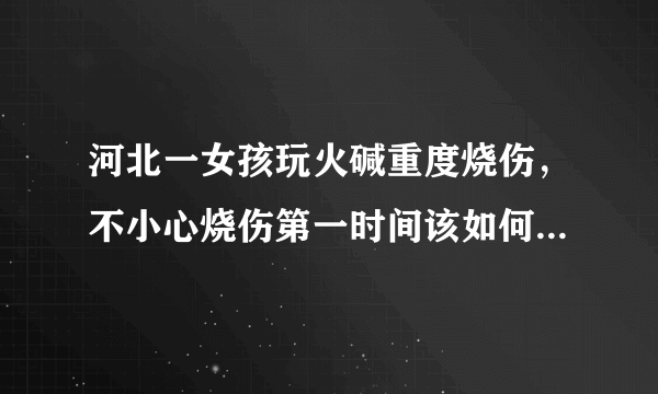 河北一女孩玩火碱重度烧伤，不小心烧伤第一时间该如何处理伤口？