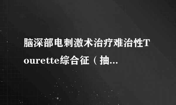 脑深部电刺激术治疗难治性Tourette综合征（抽动秽语综合征）的临床疗效观察