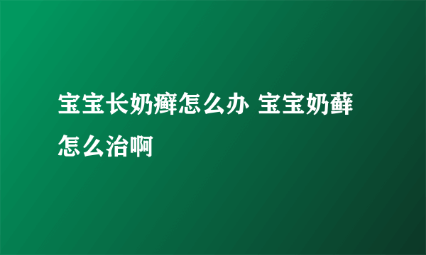 宝宝长奶癣怎么办 宝宝奶藓怎么治啊