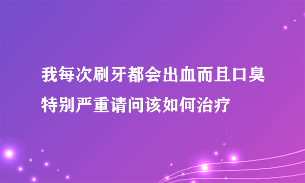 我每次刷牙都会出血而且口臭特别严重请问该如何治疗