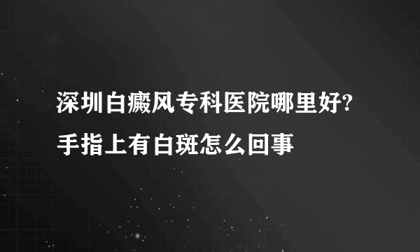 深圳白癜风专科医院哪里好?手指上有白斑怎么回事