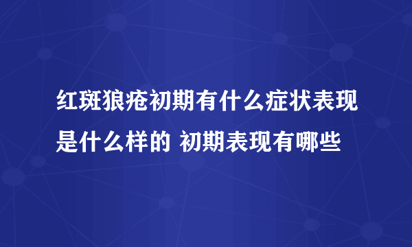 红斑狼疮初期有什么症状表现是什么样的 初期表现有哪些