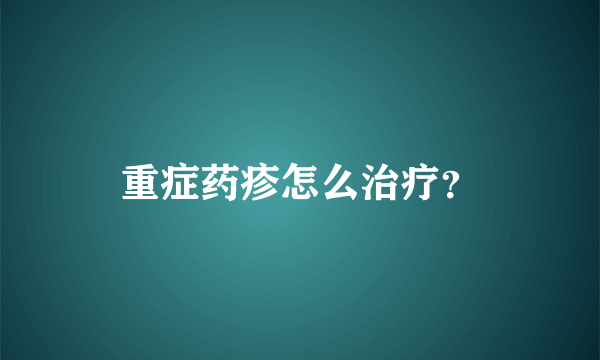 重症药疹怎么治疗？