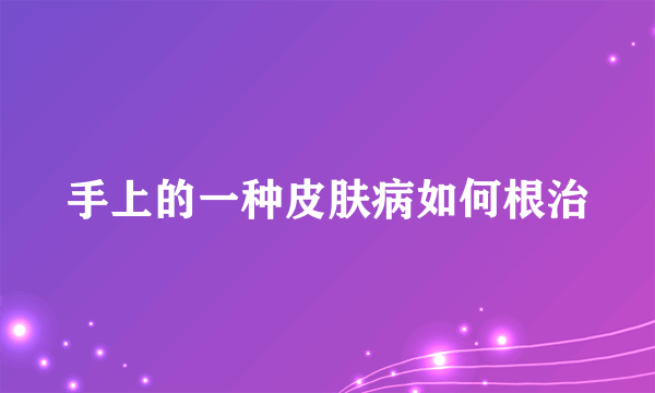 手上的一种皮肤病如何根治