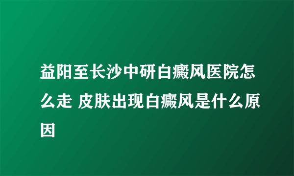 益阳至长沙中研白癜风医院怎么走 皮肤出现白癜风是什么原因