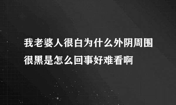 我老婆人很白为什么外阴周围很黑是怎么回事好难看啊