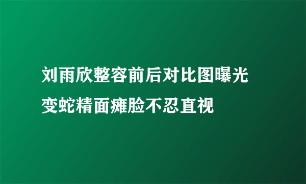 刘雨欣整容前后对比图曝光 变蛇精面瘫脸不忍直视