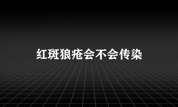 红斑狼疮会不会传染