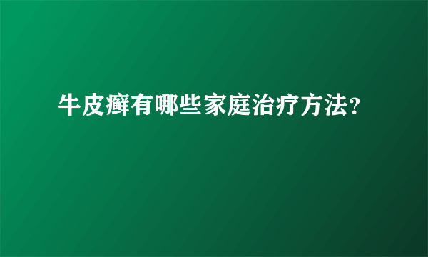 牛皮癣有哪些家庭治疗方法？