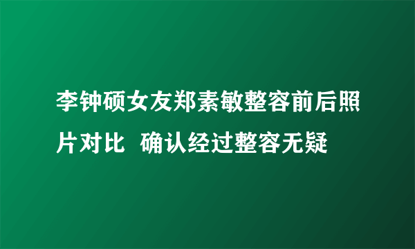 李钟硕女友郑素敏整容前后照片对比  确认经过整容无疑