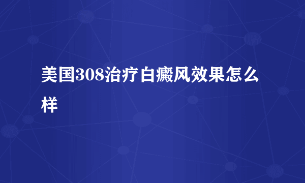 美国308治疗白癜风效果怎么样