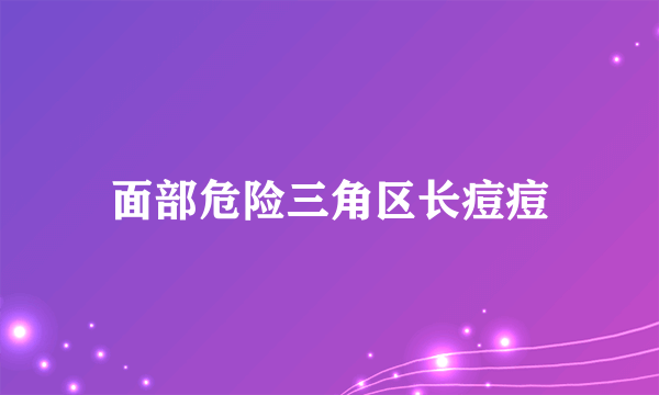 面部危险三角区长痘痘