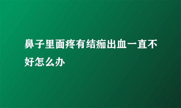 鼻子里面疼有结痂出血一直不好怎么办