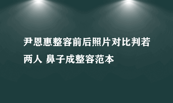 尹恩惠整容前后照片对比判若两人 鼻子成整容范本