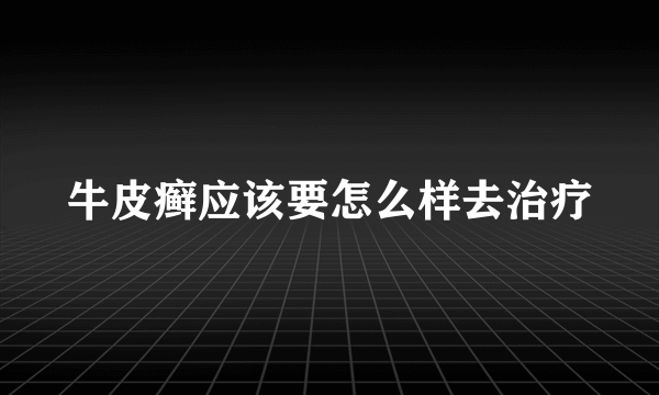 牛皮癣应该要怎么样去治疗