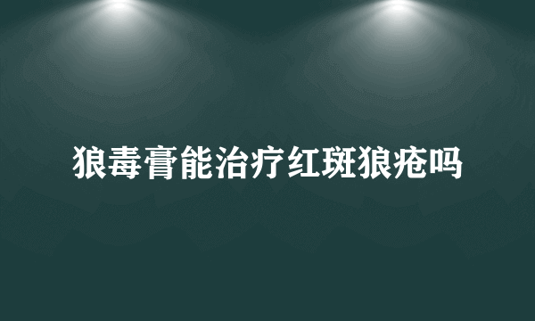 狼毒膏能治疗红斑狼疮吗