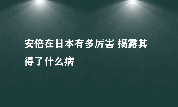 安倍在日本有多厉害 揭露其得了什么病