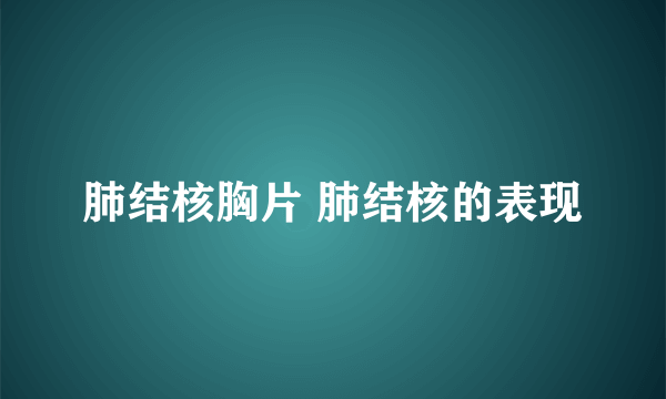 肺结核胸片 肺结核的表现