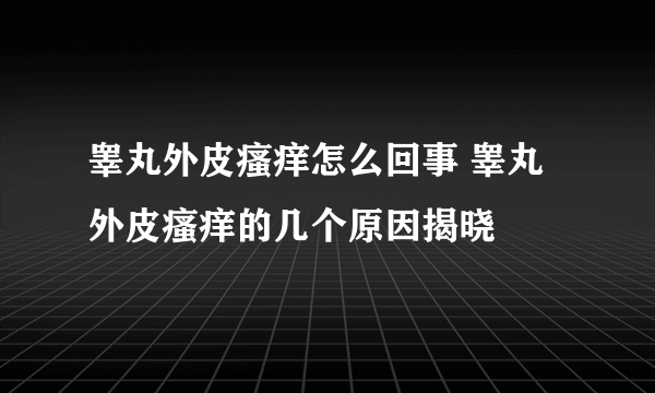 睾丸外皮瘙痒怎么回事 睾丸外皮瘙痒的几个原因揭晓