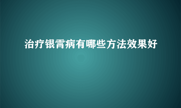 治疗银霄病有哪些方法效果好