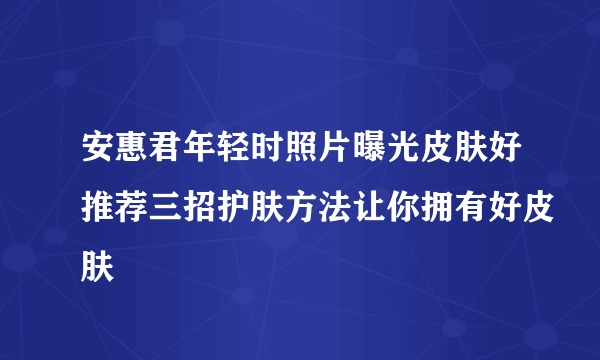 安惠君年轻时照片曝光皮肤好推荐三招护肤方法让你拥有好皮肤