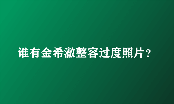 谁有金希澈整容过度照片？