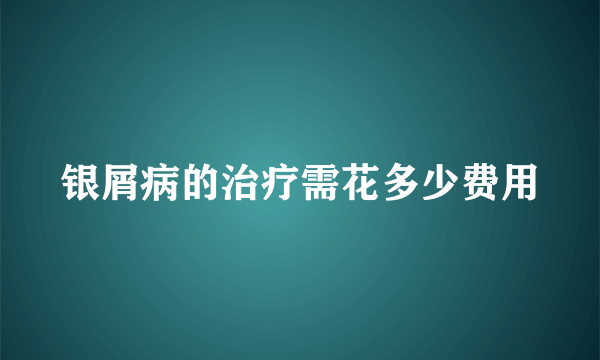 银屑病的治疗需花多少费用