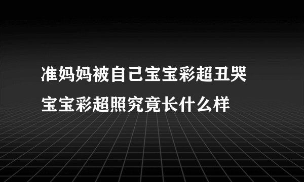 准妈妈被自己宝宝彩超丑哭 宝宝彩超照究竟长什么样