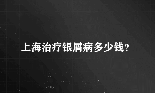 上海治疗银屑病多少钱？