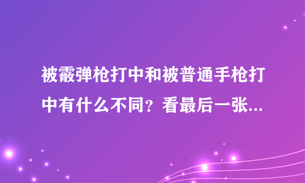 被霰弹枪打中和被普通手枪打中有什么不同？看最后一张图就明白了