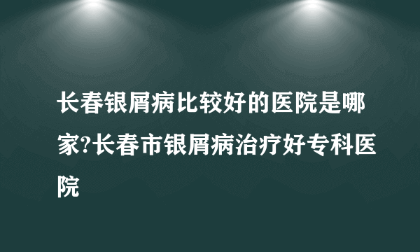 长春银屑病比较好的医院是哪家?长春市银屑病治疗好专科医院