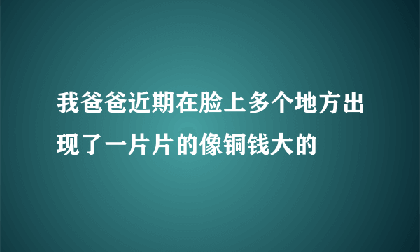 我爸爸近期在脸上多个地方出现了一片片的像铜钱大的