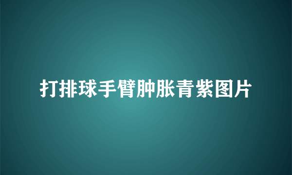 打排球手臂肿胀青紫图片