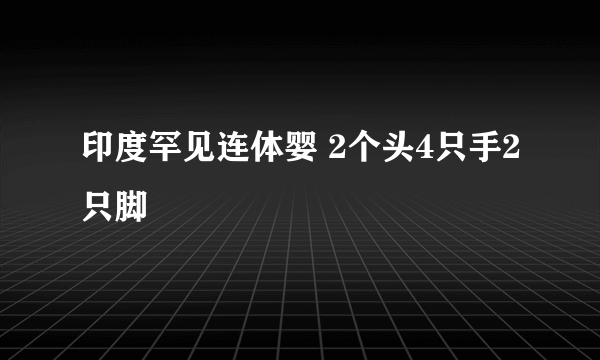 印度罕见连体婴 2个头4只手2只脚