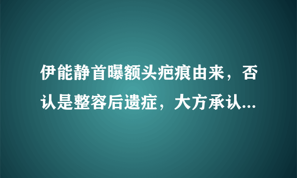 伊能静首曝额头疤痕由来，否认是整容后遗症，大方承认割过双眼皮