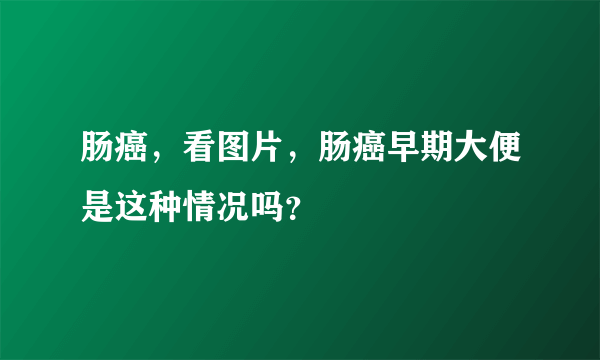 肠癌，看图片，肠癌早期大便是这种情况吗？