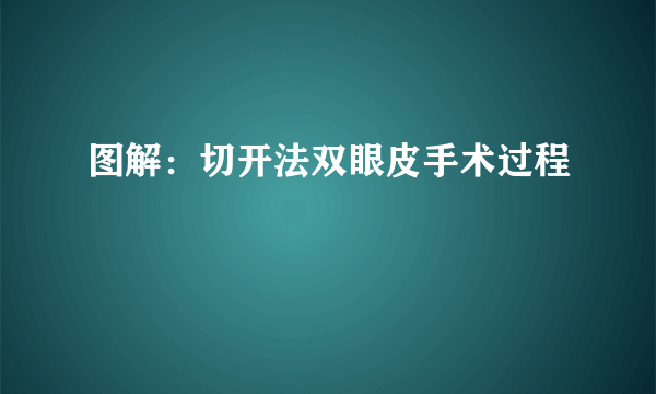 图解：切开法双眼皮手术过程